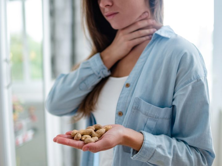 FSAI Issues Precautionary Warning for Consumers with a Peanut Allergy
